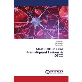 Mast Cells in Oral Premalignant Lesions & OSCC
