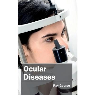 Ocular Diseases