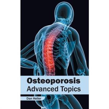 Osteoporosis: Advanced Topics