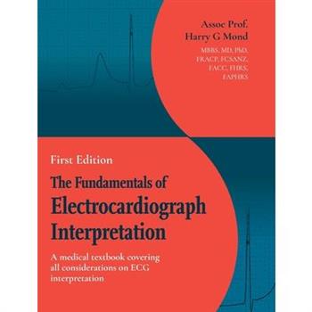 The Fundamentals of Electrocardiograph Interpretation