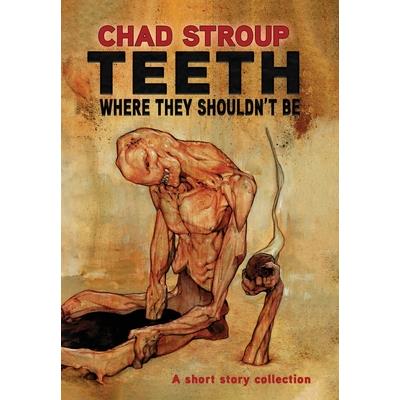 Teeth Where They Shouldn’t Be