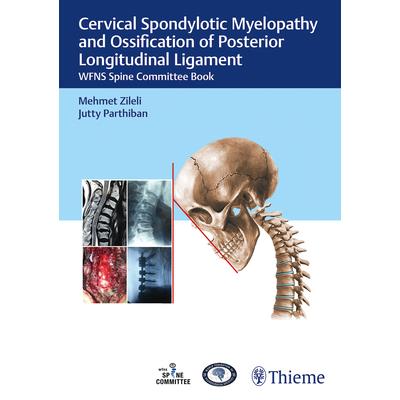 Cervical Spondylotic Myelopathy and Ossification of Posterior Longitudinal Ligament