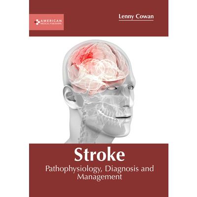 Stroke: Pathophysiology, Diagnosis and Management