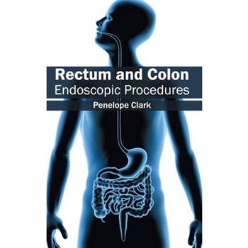 Rectum and Colon: Endoscopic Procedures