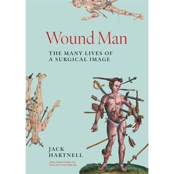 Wound Man