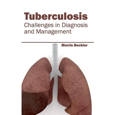 Tuberculosis: Challenges in Diagnosis and Management