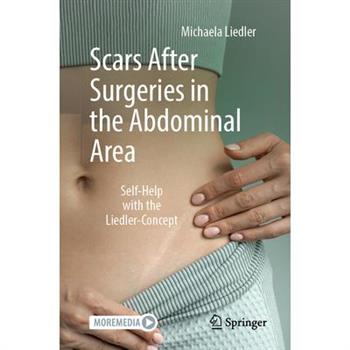 Scars After Surgeries in the Abdominal Area