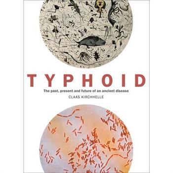 Typhoid