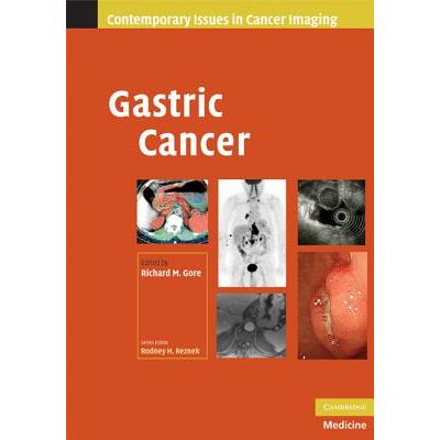 Gastric Cancer