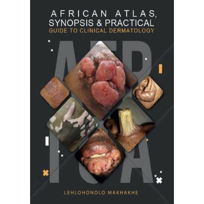 African Atlas, Synopsis & Practical Guide to Clinical Dermatology