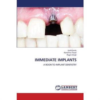 Immediate Implants