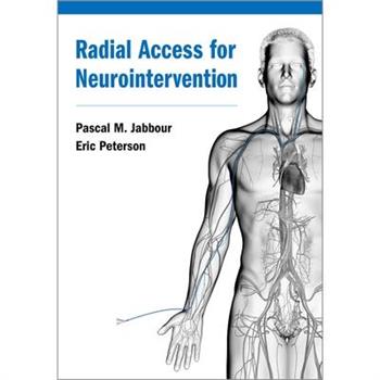 Radial Access for Neurointervention