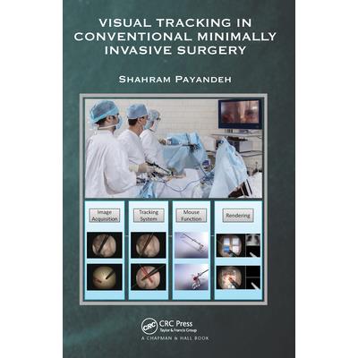 Visual Tracking in Conventional Minimally Invasive Surgery