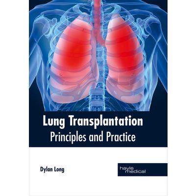 Lung Transplantation: Principles and Practice