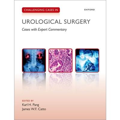 Challenging Cases in Urological Surgery