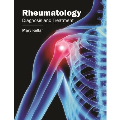 Rheumatology: Diagnosis and Treatment