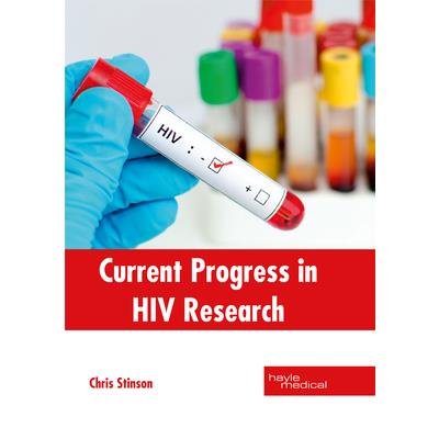 Current Progress in HIV Research