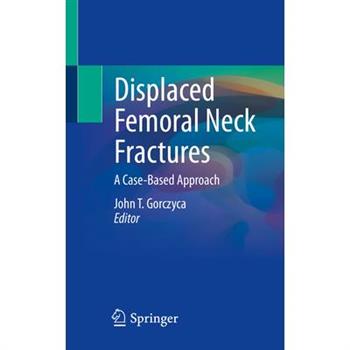 Displaced Femoral Neck Fractures