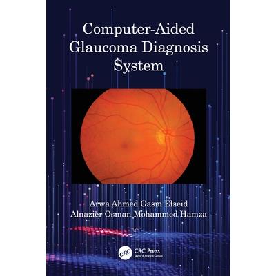 Computer-Aided Glaucoma Diagnosis System