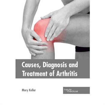 Causes, Diagnosis and Treatment of Arthritis
