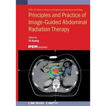 Principles and Practice of Image-Guided Abdominal Radiation Therapy