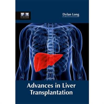 Advances in Liver Transplantation