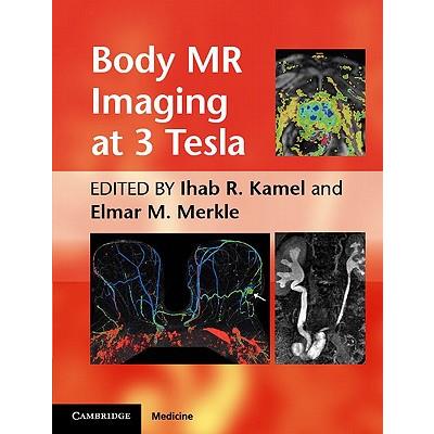 Body Mr Imaging at 3.0 Tesla