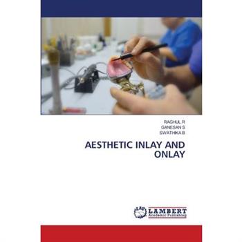 Aesthetic Inlay and Onlay