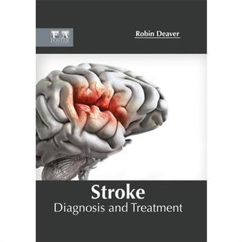 Stroke: Diagnosis and Treatment