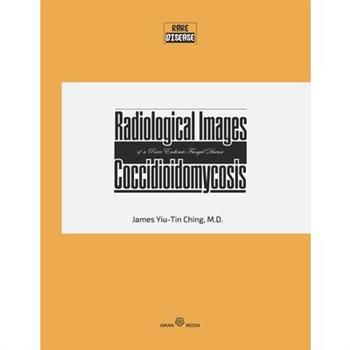 Radiological Images of a Rare Endemic Fungal Disease Coccidioidomycosis