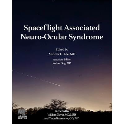 Spaceflight Associated Neuro-Ocular Syndrome
