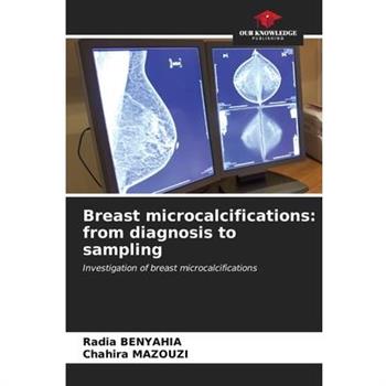Breast microcalcifications