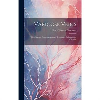 Varicose Veins