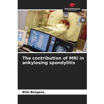 The contribution of MRI in ankylosing spondylitis