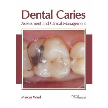 Dental Caries: Assessment and Clinical Management