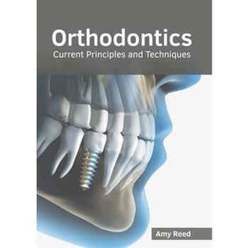 Orthodontics: Current Principles and Techniques