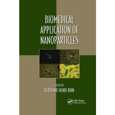 Biomedical Application of Nanoparticles