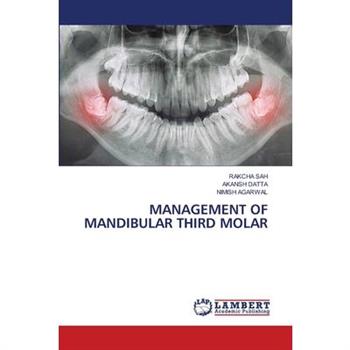 Management of Mandibular Third Molar