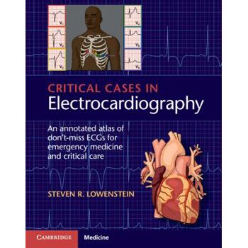 Critical Cases in Electrocardiography