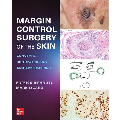 Margin Control Surgery of the Skin: Concepts, Histopathology, and Applications