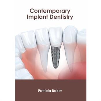 Contemporary Implant Dentistry