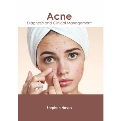 Acne: Diagnosis and Clinical Management