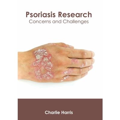 Psoriasis Research: Concerns and Challenges