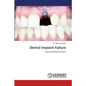 Dental Implant Failure