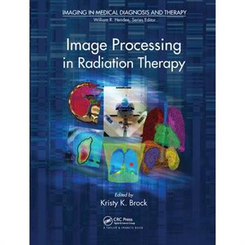 Image Processing in Radiation Therapy
