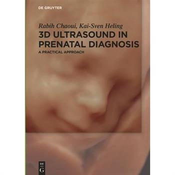 3d Ultrasound in Prenatal Diagnosis