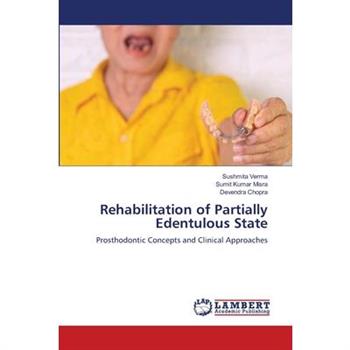Rehabilitation of Partially Edentulous State