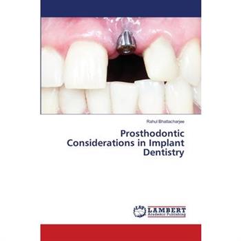 Prosthodontic Considerations in Implant Dentistry