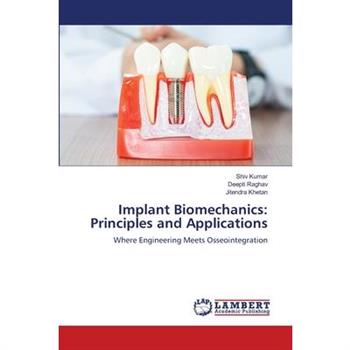 Implant Biomechanics