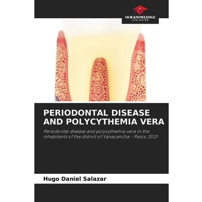 Periodontal Disease and Polycythemia Vera